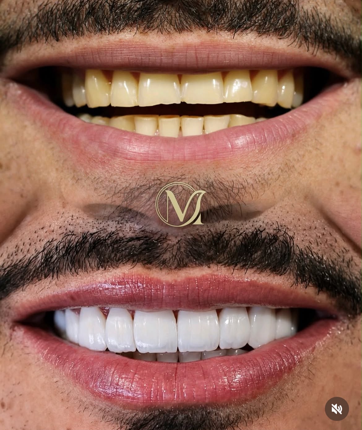 Resultado real: antes e depois frontal