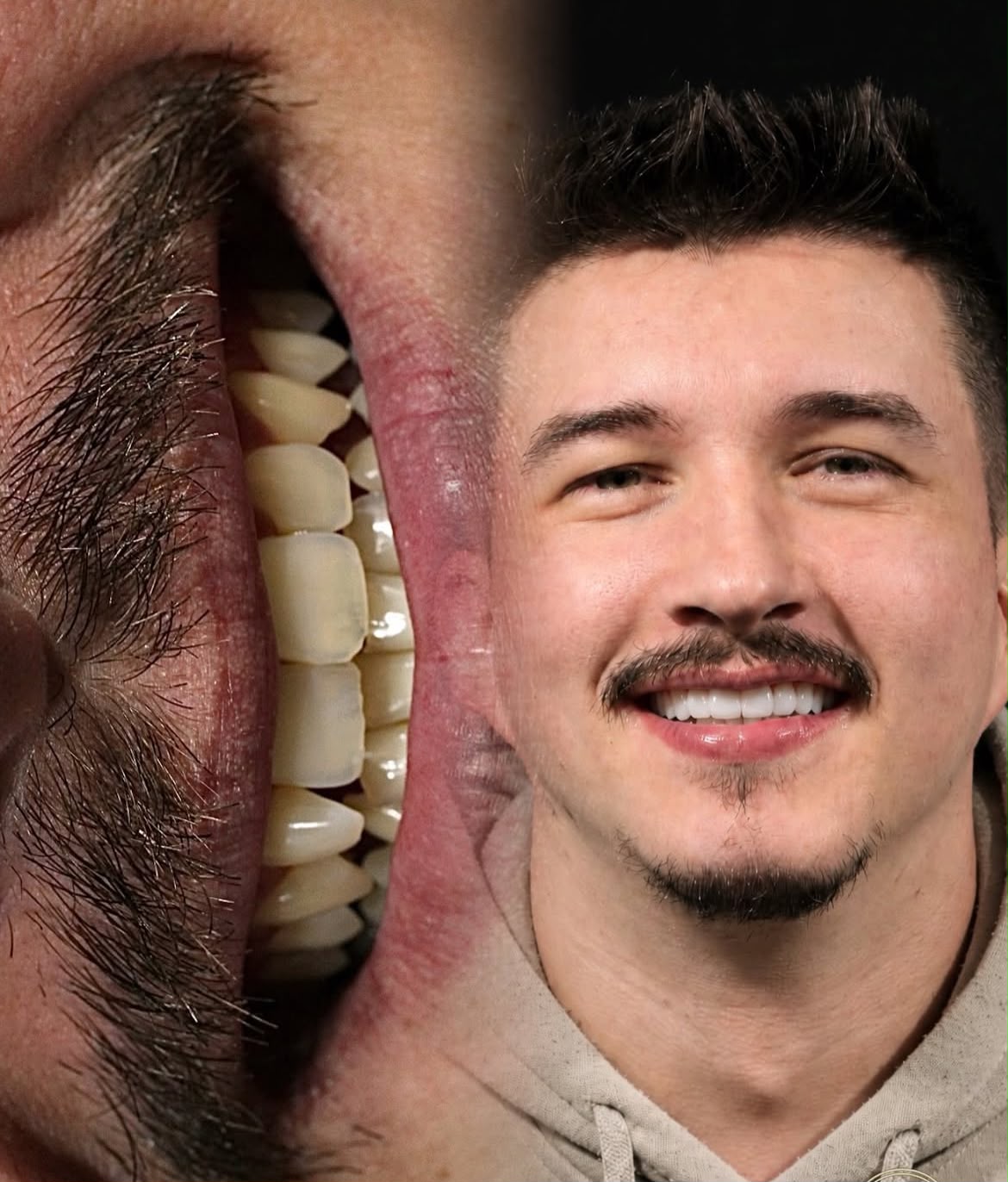 Resultado real: retrato e sorriso