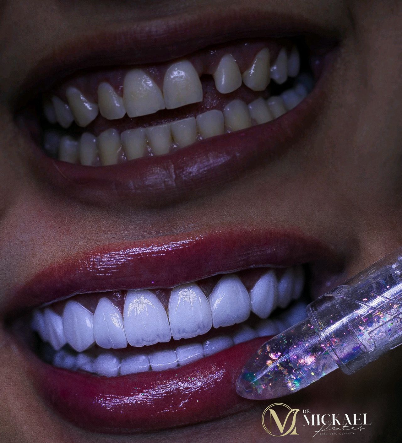 Sorriso sofisticado