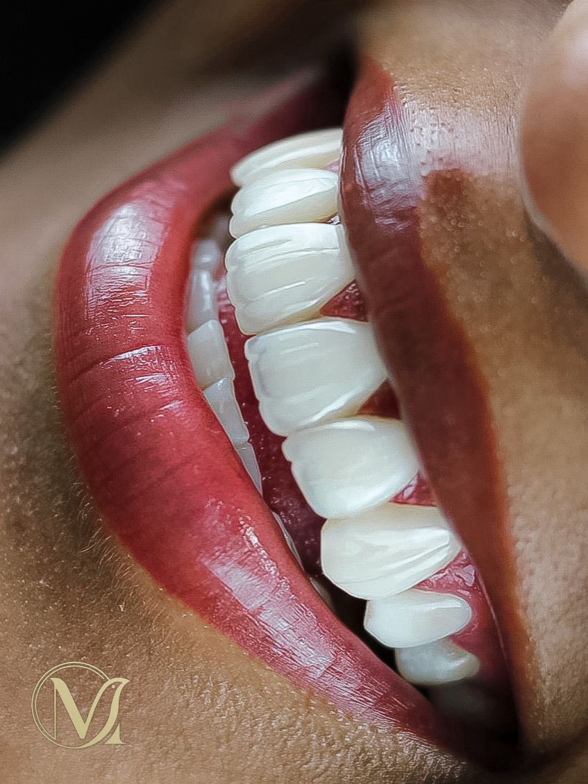 Naturalidade Premium